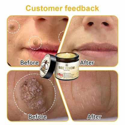 Bee Venom Anti-Wrinkle Elixir Tightening & Dark Spot Repair سيروم سم النحل للبشرة وتفتيح البقع